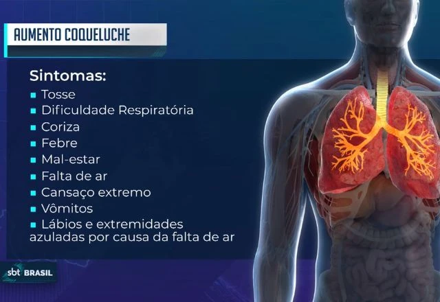 Ministério da Saúde reforça cuidados com a coqueluche