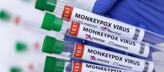  Saúde negocia compra de 25 mil doses de vacina contra mpox