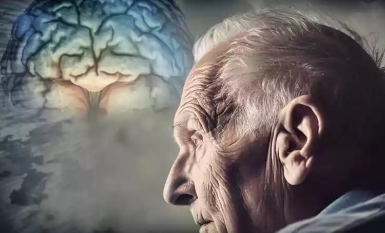Sinal escondido no cérebro pode revelar Alzheimer anos antes dos sintomas, aponta estudo