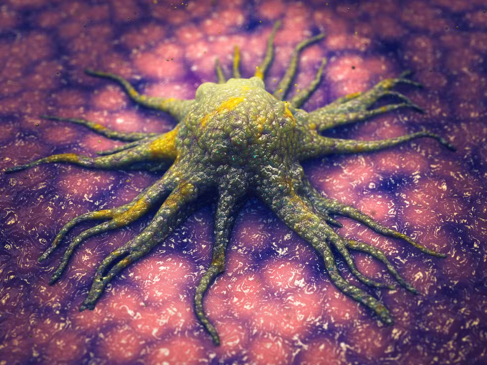 Cientistas descobrem molécula que 'mata de fome' células cancerígenas sem afetar tecidos saudáveis