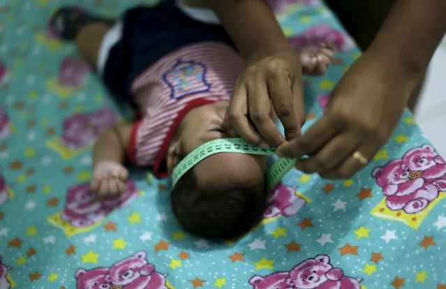 Brasil confirmou 246 casos de microcefalia e outras alterações ligadas à zika em 2017