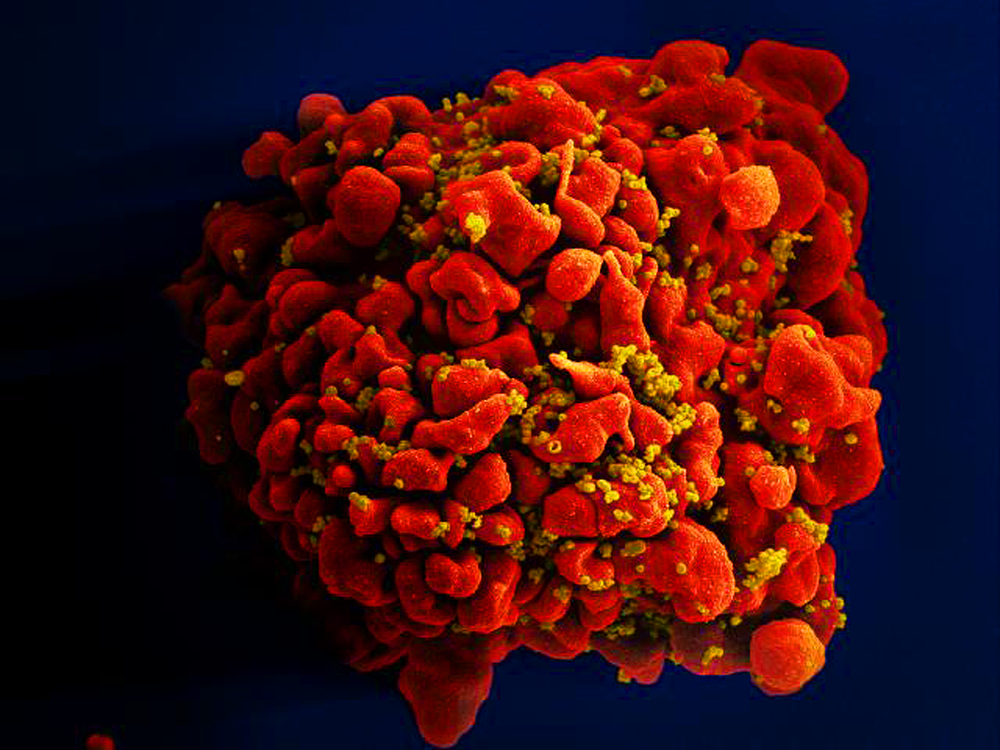 Estudos de nova vacina e remédio de ação prolongada aumentam esperanças em luta contra o HIV