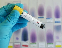 Estudo descreve método para "treinar" anticorpos contra o HIV