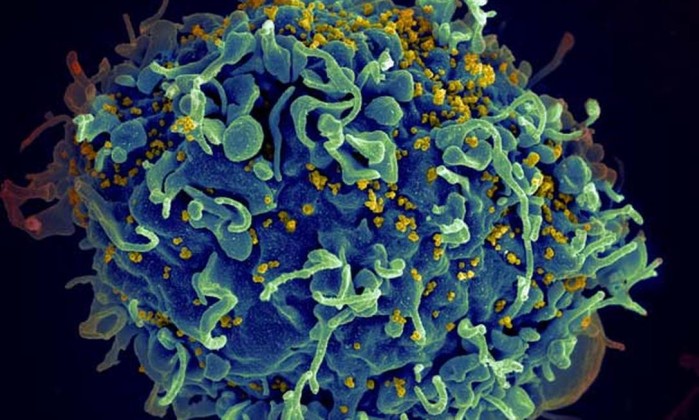 Anticorpo criado em laboratório combate 99% das cepas de HIV  